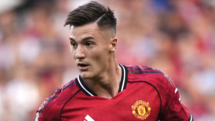 Sesko Bersinar di Era Pasca Amorim, Manchester United Ditahan Burnley 2-2