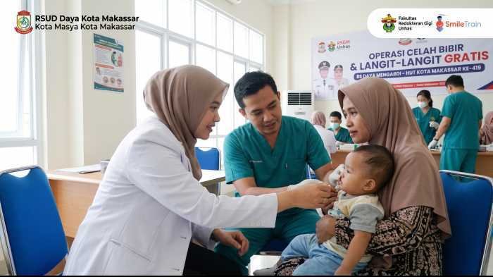 RSUD Daya dan RSGM Unhas Gelar Operasi Celah Bibir Gratis, Ini Syarat dan Cara Daftarnya